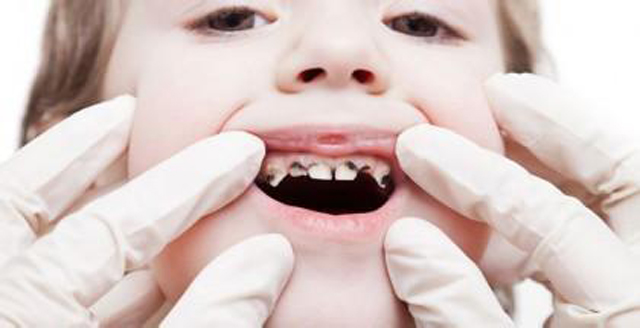 Child Dental MRC | Dentist Open Sunday Adelaide